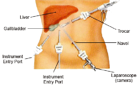 Surgery rotation operating room medical school